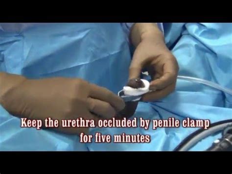 How to Stretch Urethra: Exploring Unconventional Methods and Their Implications