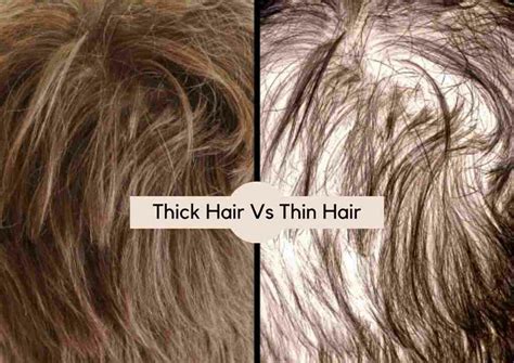 Is Thick Hair Healthy? Exploring the Myths and Realities of Hair Density