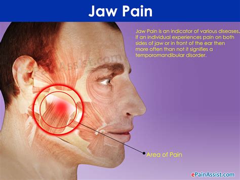 Jaw Pain When Running: A Symphony of Discomfort and Determination